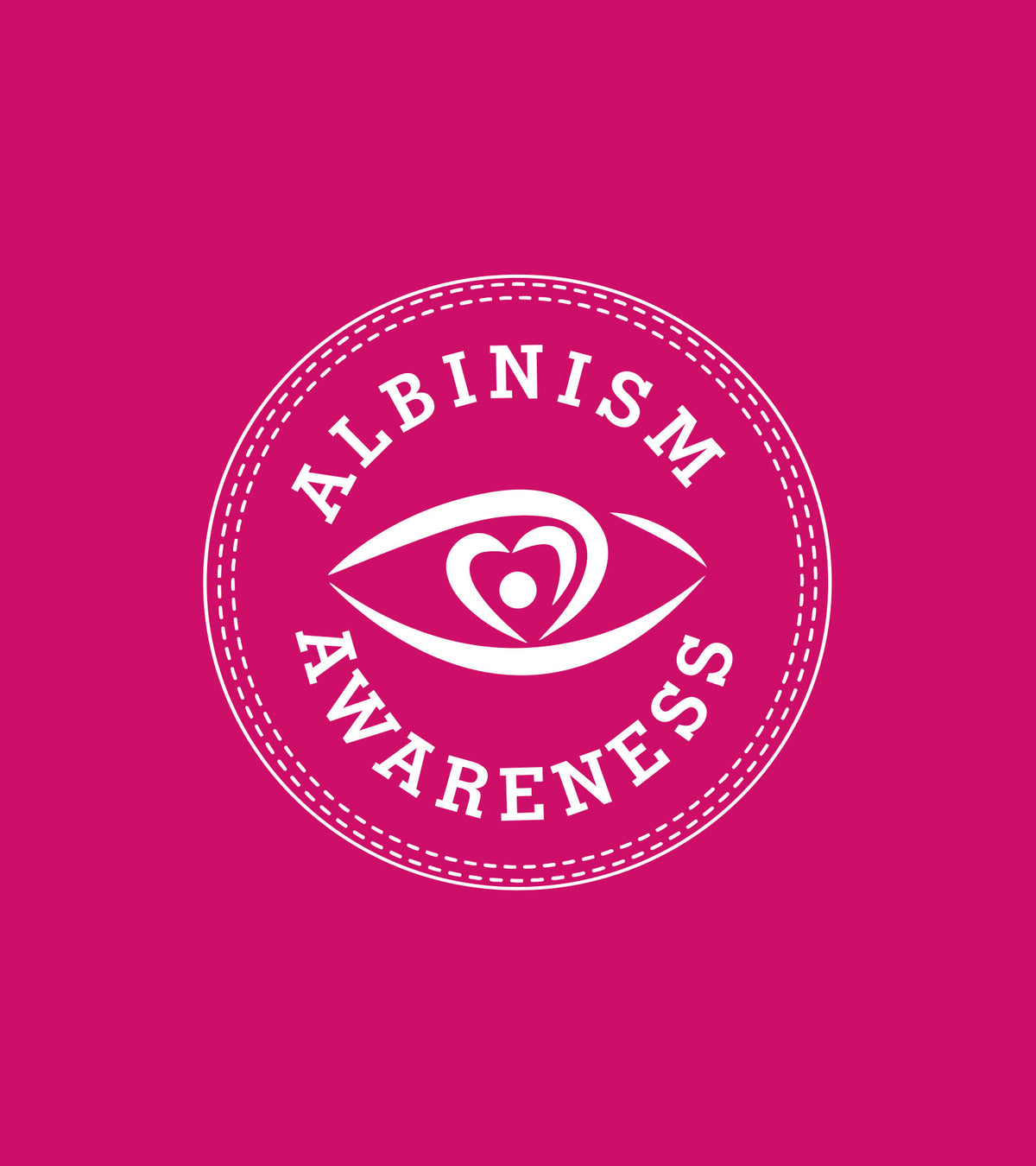 Albinism - Knee